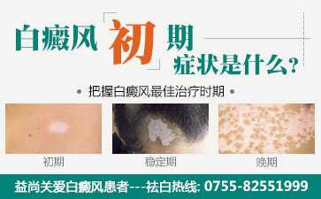 深圳白癜风医院讲解儿童白斑的怎么治疗效果好
