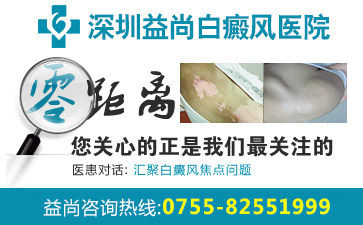 深圳宝安区有没有好的白斑医院?导致女性患上白癜风的因素有哪些