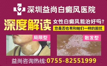 深圳宝安区白斑病治疗医院女性白斑患者应该如何护理